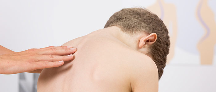 Chiropractic Care in Jacksonville For Scoliosis Relief